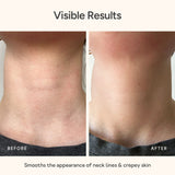 Before and after comparison of neck lines and crepey skin smoothing effect. Close-up of neck skin before and after using Bare Intent’s reusable anti-wrinkle neck patch. Before shows visible fine lines and creases across neck; after shows smoother, visibly plumper skin with reduced wrinkles.