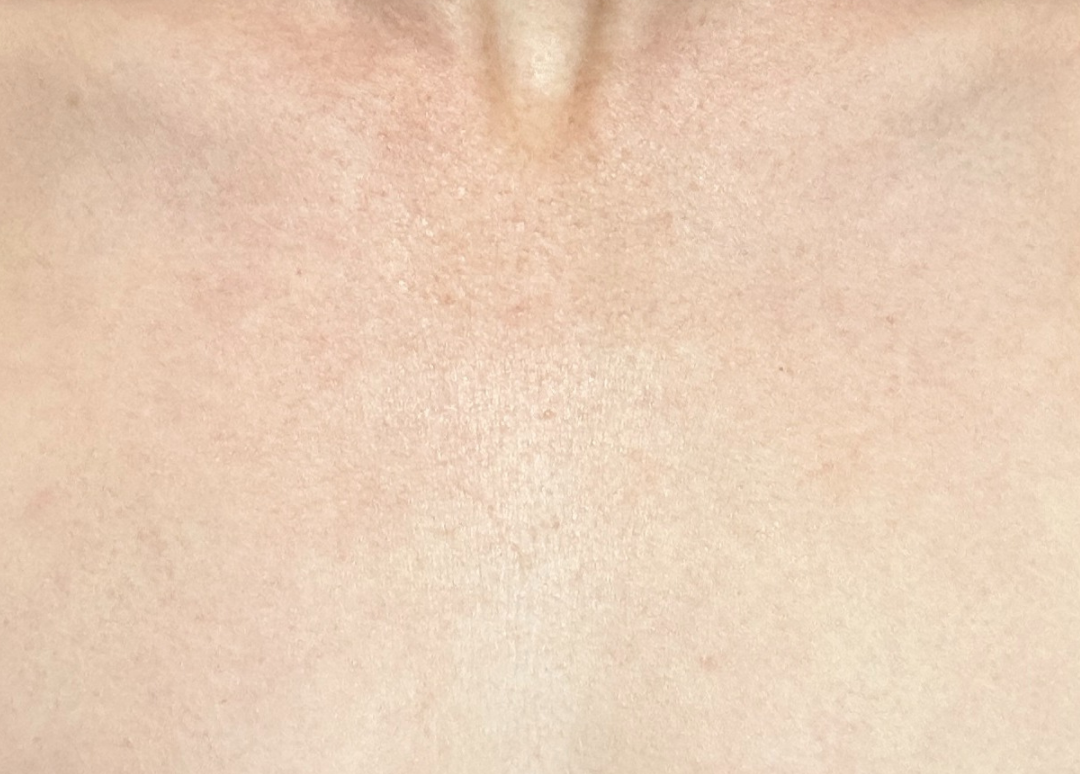 Close-up of chest skin before and after using Bare Intent’s reusable anti-wrinkle chest patch. Before shows visible fine lines and creases across décolleté; after shows smoother, visibly plumper skin with reduced wrinkles.